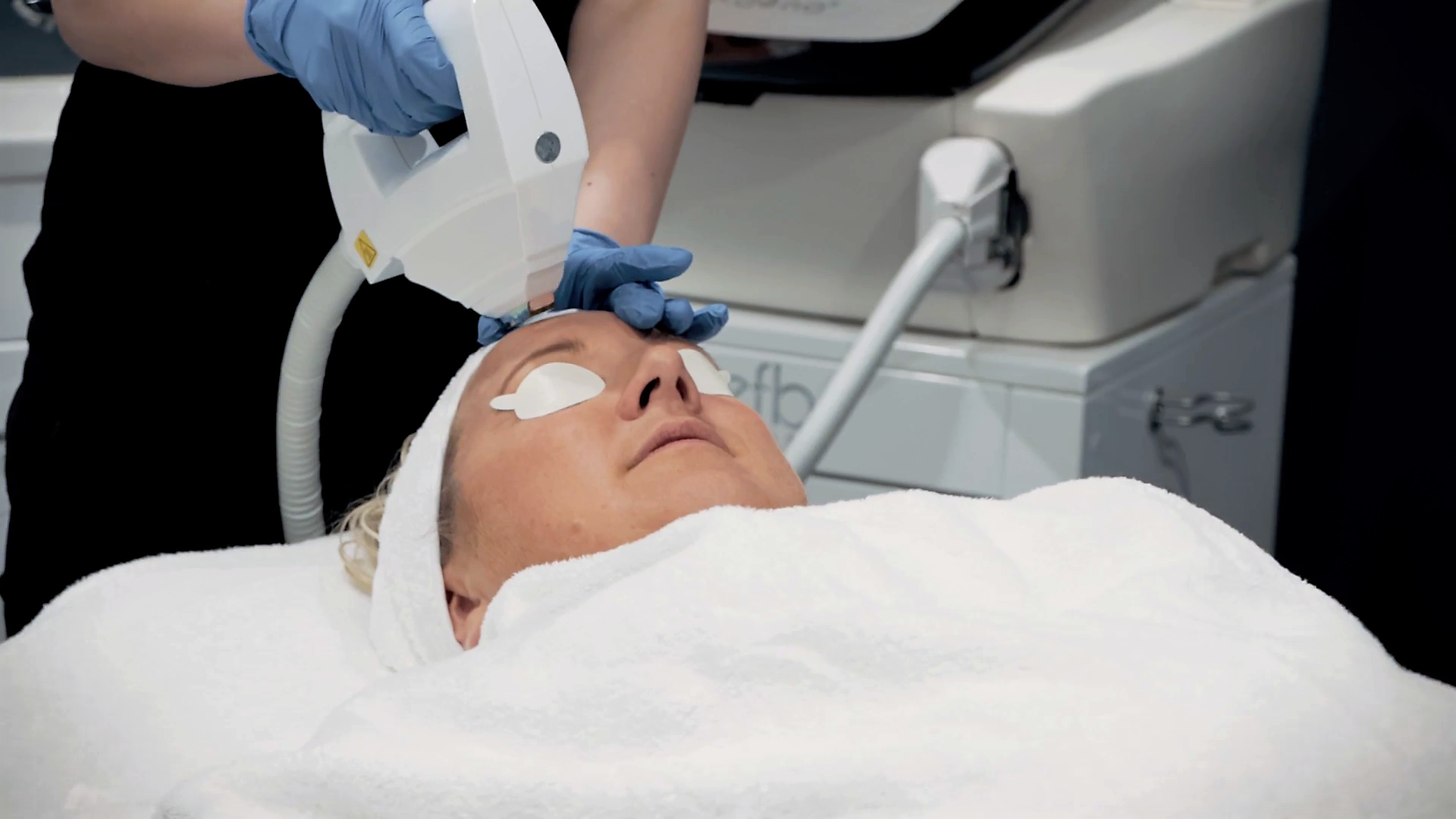 IPL Phillippa (1) We provide skin IPL services